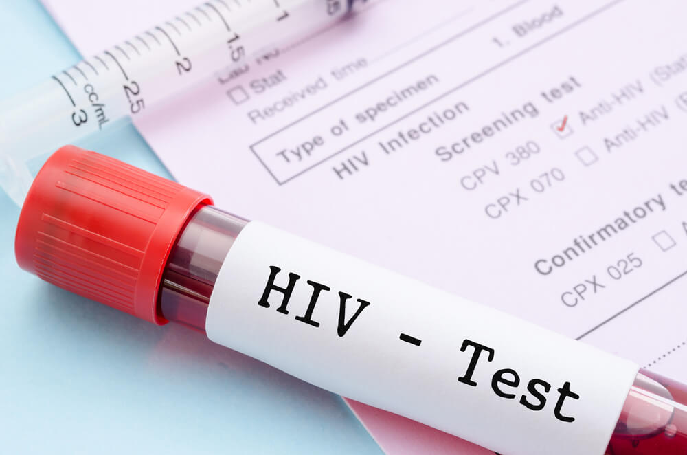 HIV Antikor Testi (AİDS) image