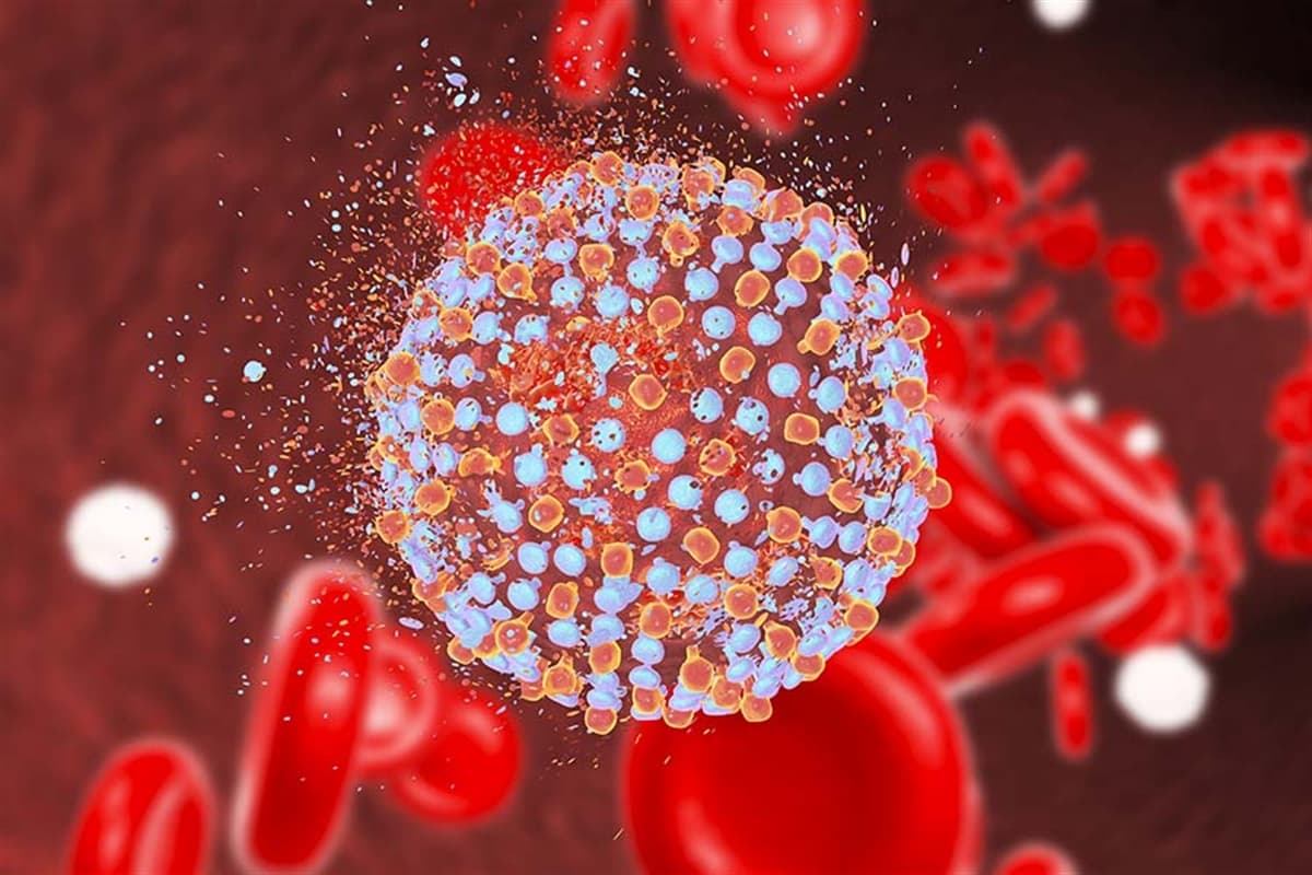 Anti HCV (Hepatit C) image
