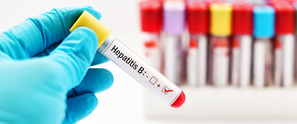 Hepatit B Antikor testi (Anti HBS) image