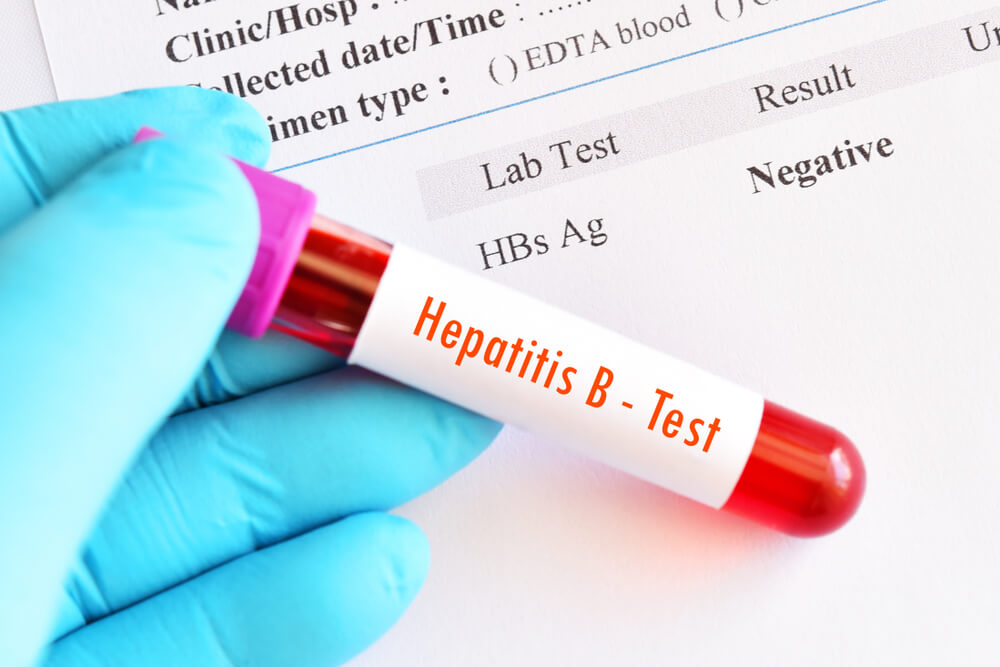 Hepatit B Testi (HBSAg) image